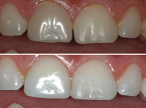 OdontoiatriaEstetica_2
