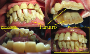paradontologia_1