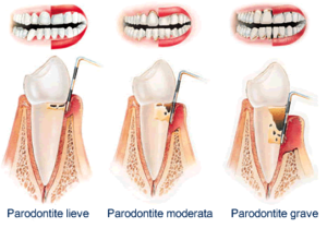 paradontologia_2
